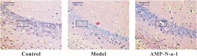 Effects of an Armillaria mellea Polysaccharide on Learning and Memory of D-Galactose-Induced Aging Mice